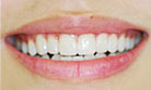 toothcosmetic07